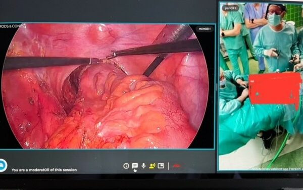 Zaawansowana operacja laparoskopowa po raz pierwszy transmitowana ze Szpitala Rydygiera do ośrodków medycznych w Europie